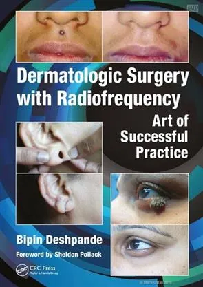 Dermatologic Surgery With Radiofrequency Art ...