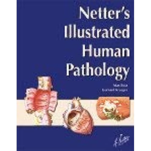 Netters Illustrated Human Pathology (Pb 2004)...