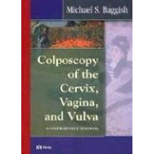 Colposcopy Of The Cervix, Vagina, And Vulva: ...