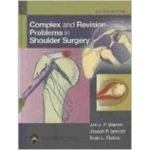 Complex And Revision Problems In Shoulder Sur...