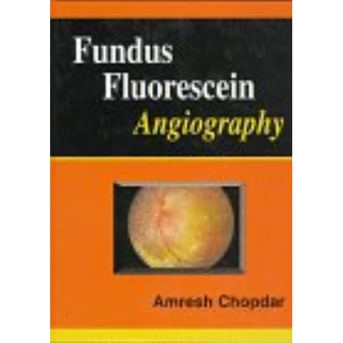 Fundus Fluorescein Angiography 