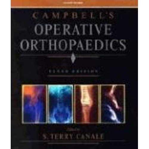 Campbell'S Operative Orthopaedics, 10 Ed (Cd)...