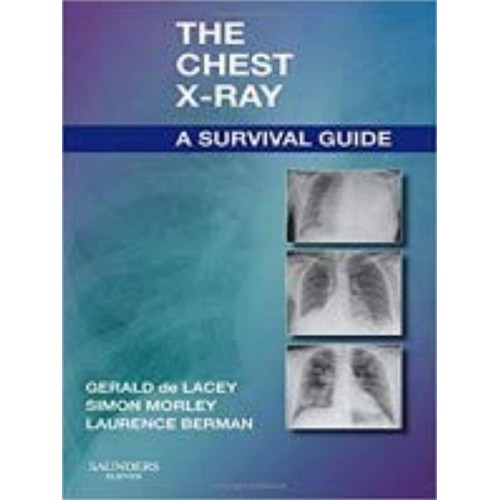 The Chest X-Ray A Survival Guide (Pb 2020)