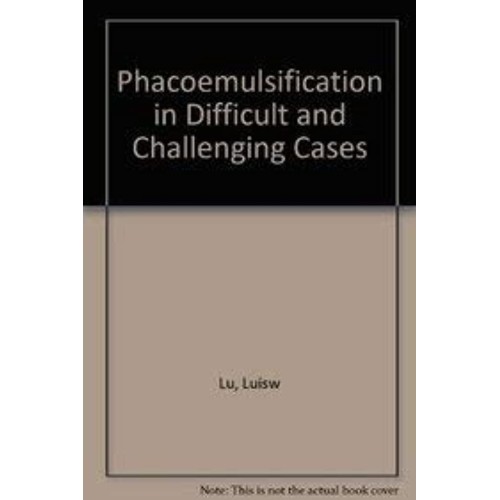 Phacoemulsification In Difficult And Challeng...