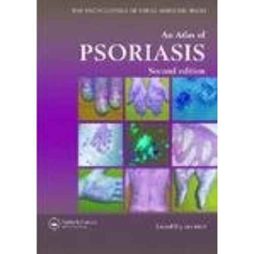 An Atlas Of Psoriasis (Encyclopedia Of Visual...