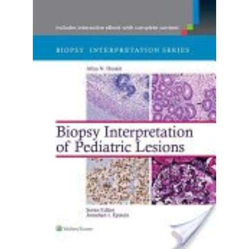 Biopsy Interpretation Of Pediatric Lesions (H...