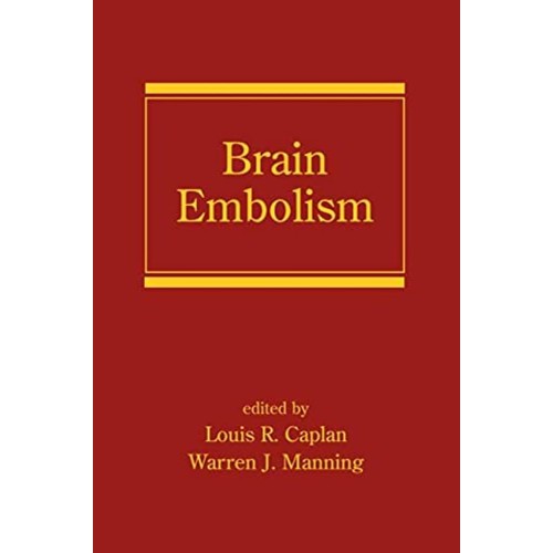 Brain Embolism 