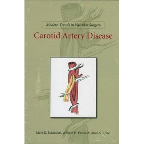 Carotid Artery Disease 2010