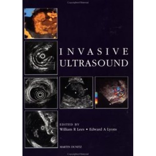 Invasive Ultrasound: A Text Atlas 