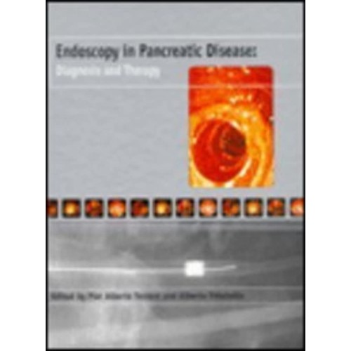 Endoscopy In Pancreatic Disease: Diagnsis And...