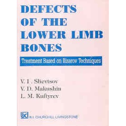 Defects Of The Lower Limb Bones 