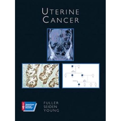 Uterine Cancer: American Cancer Society Atlas...