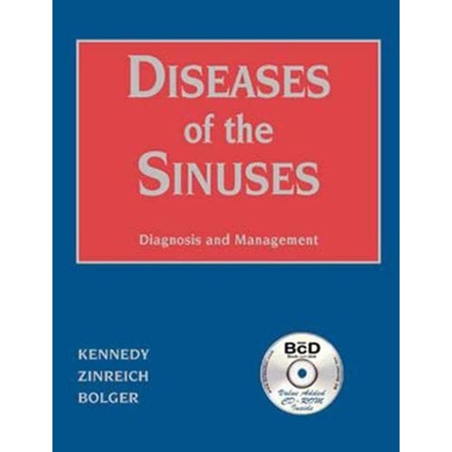 Diseases Of The Sinuses Diagnosis And Managem...