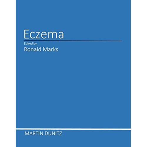 Eczema 