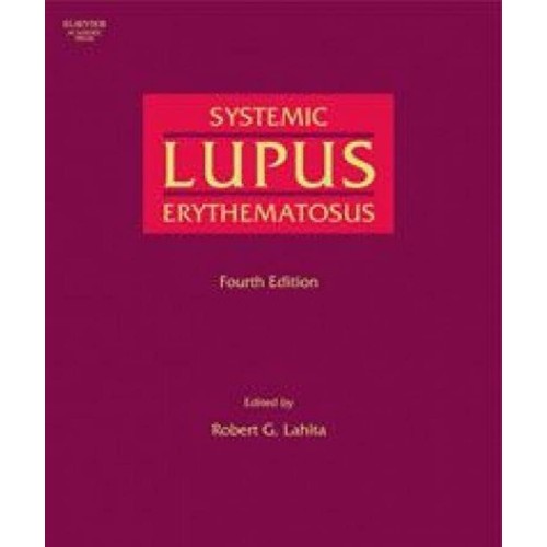 Systemic Lupus Erythematosus, 4/E 