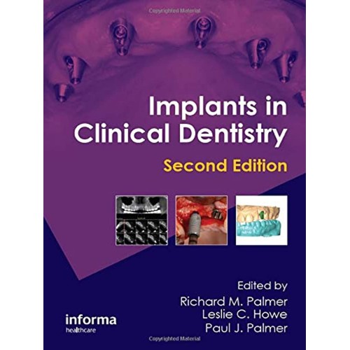 Implants In Clincal Dentistry 2Ed (Hb) Spl Pr...