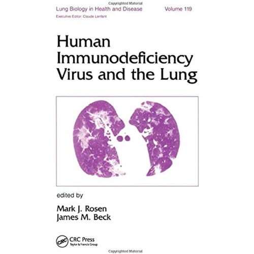 Human Immunodeficiency Virus And The Lung, Vo...