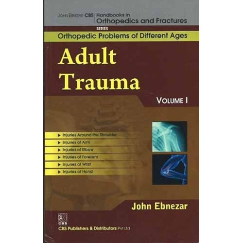 Adult Trauma Vol 1 (Handbooks In Orthopedics ...