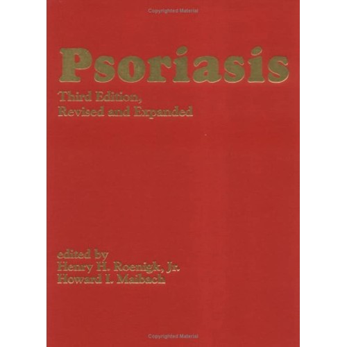 Psoriasis 3/E Revised And Expanded 