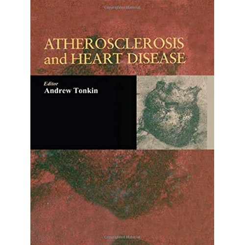 Atherosclerosis And Heart Disease 