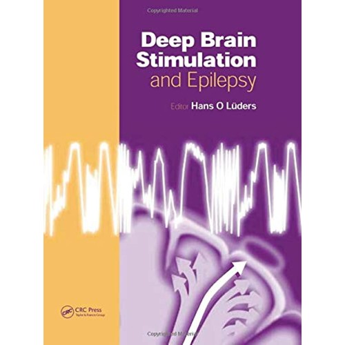 Deep Brain Stimulation And Epilepsy 