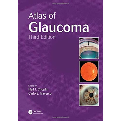 Atlas Of Glaucoma 3Ed (Hb 2014) 