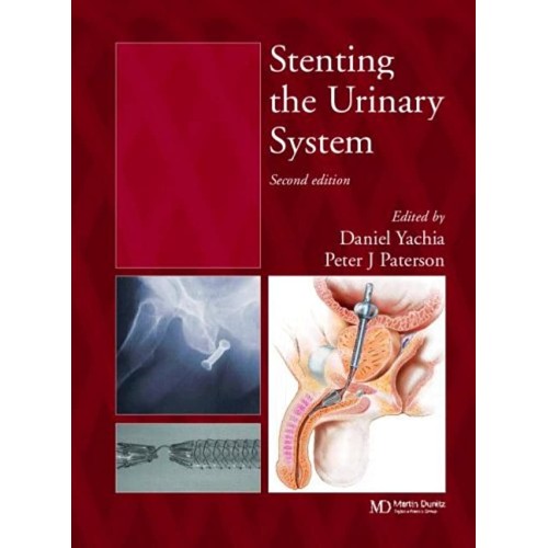 Stenting The Urinary Systems 2E (Hb 2004)