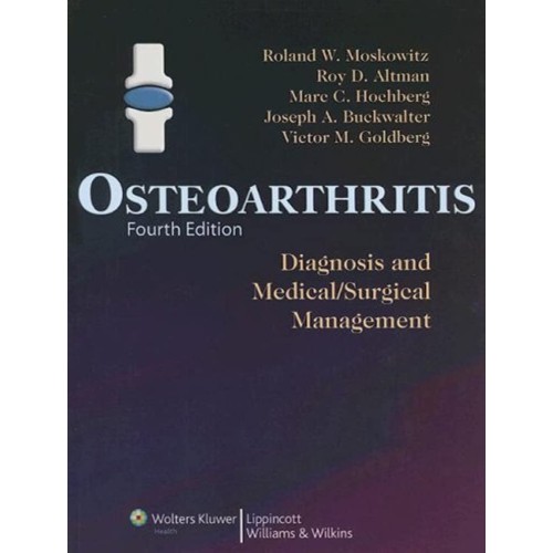 Osteoarthritis Diagnosis & Medical  Surgical ...