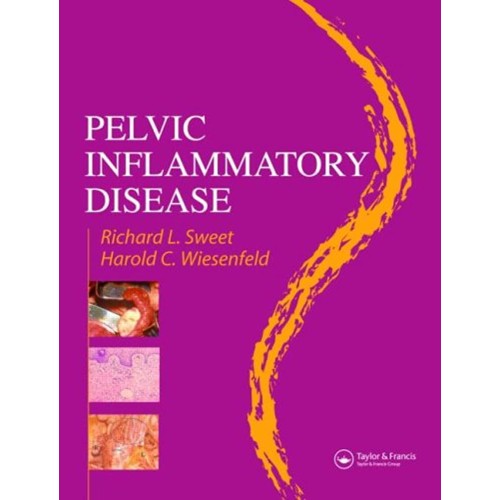 Pelvic Inflammatory Disease 