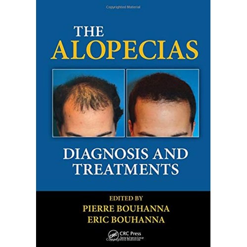 The Alopecias Diagnosis And Treatments (Hb 20...