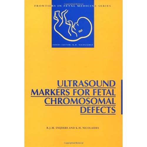 Ultrasound Markers For Fetal Chromosomal Defe...