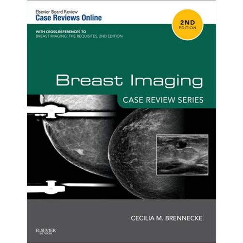 Breast Imaging Case Review Series 2Ed (Pb 201...