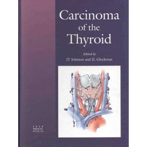 Carcinoma Of The Thyroid 