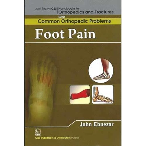 Foot Pain (Handbooks In Orthopedics And Fract...