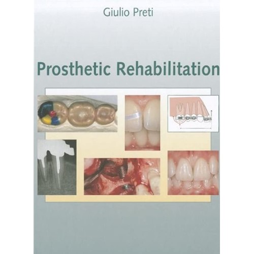 Prosthetic Rehabilitation (Hb 2007) 