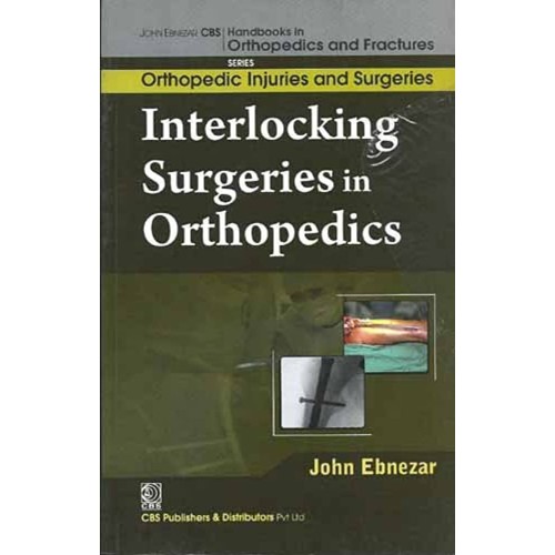 Interlocking Surgeries In Orthopedics (Handbo...