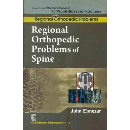 Regional Orthopedic Problems Of Spine (Handbo...