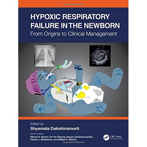 Hypoxic Respiratory Failure In The Newborn Fr...