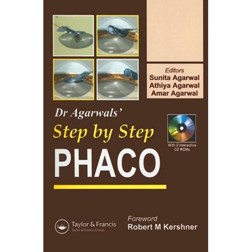 Step By Step Phaco (Pb 2005)