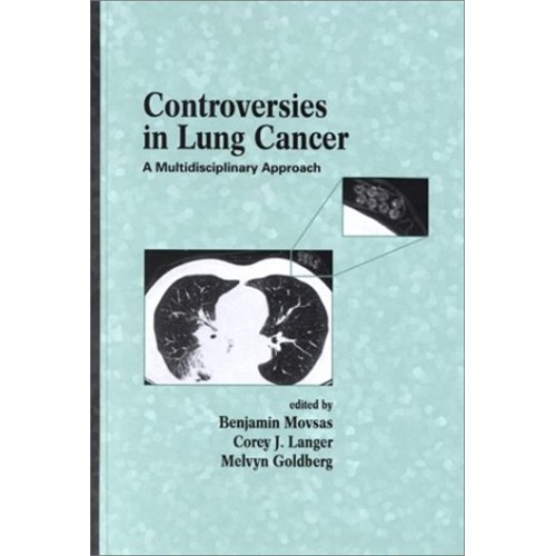 Controversies In Lung Cancer:A Multidisciplin...