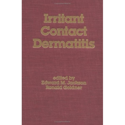 Irritant Contact Dermatitis 