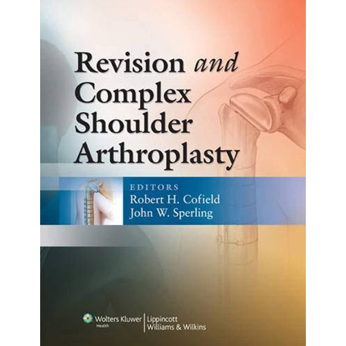 Revision & Complex Shoulder Arthroplasty (Hb)...