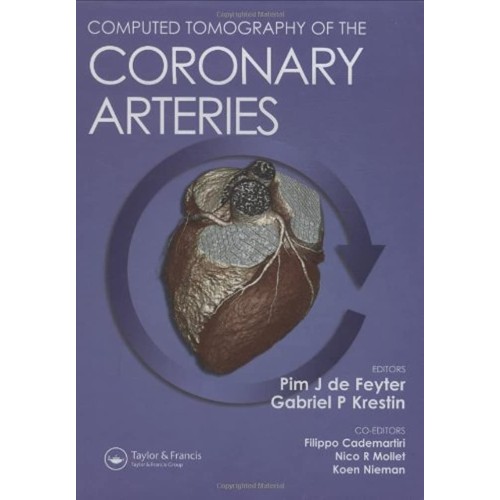 Computed Tomography Of The Coronary Arteries 