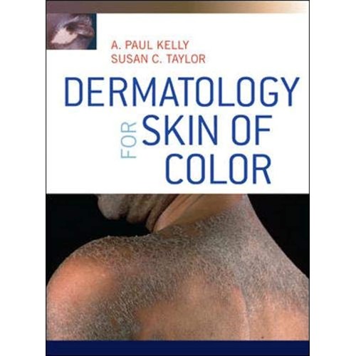 Dermatology For Skin Of Color  (Hb 2009)