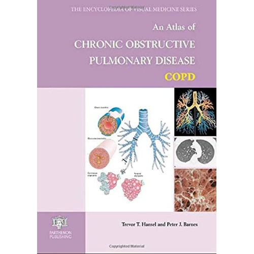 An Atlas Of Chronic Obstructive Pulmonary Dis...