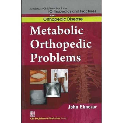 Metabolic Orthopedic Problems (Handbooks In O...