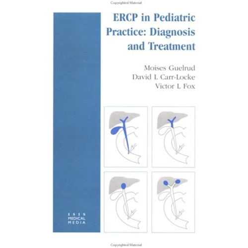 Endoscopic Retrograde Cholangiopancreatograph...