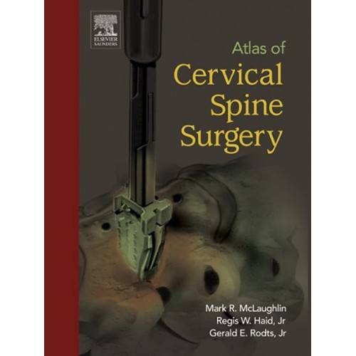 Atlas Of Cervical Spine Surgery 