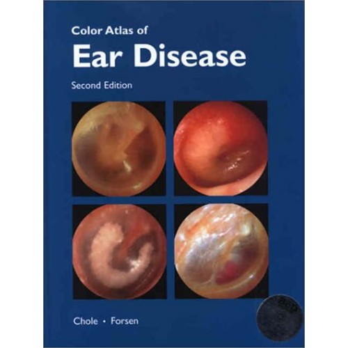 Color Atlas Of Ear Disease, 2E (Hb) 