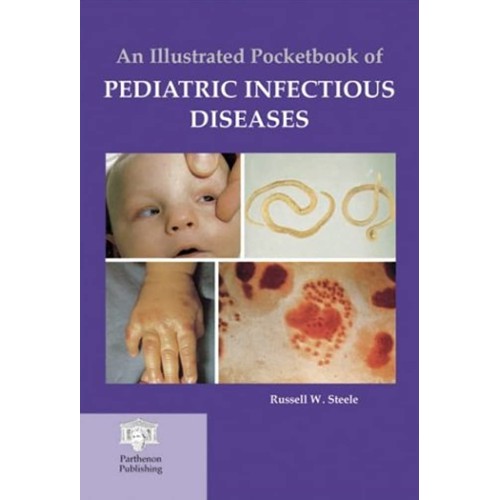 An Illustrated Pocketbook Of Pediatric Infect...